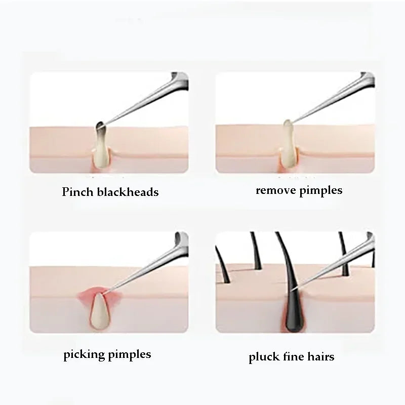 Gentle Ingrown Hair Remover Kit